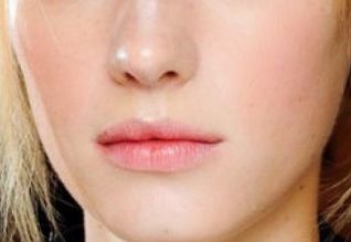 鄭州二附院馬富廉醫(yī)院特點揭秘！下頜角磨骨案例詳解！