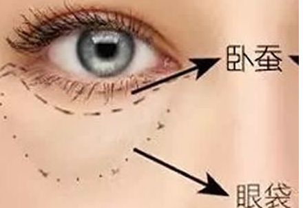 北京協(xié)和醫(yī)院隆胸案例與醫(yī)生簡(jiǎn)介含金量如何？收費(fèi)是否合理？