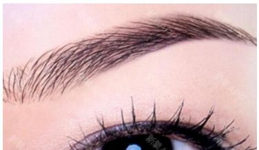 廣州做脂肪填充哪家醫(yī)院專業(yè)可靠？權(quán)威醫(yī)院排行榜揭露