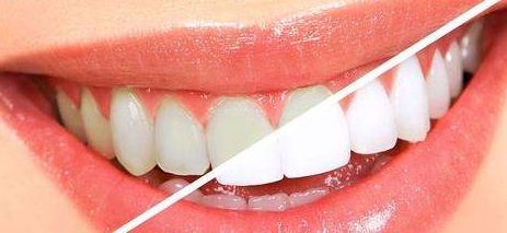 成都蔡震醫(yī)生隆鼻手術案例及費用解析