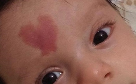 惠州心壹美醫(yī)院是技術(shù)專業(yè)的醫(yī)療機(jī)構(gòu)嗎熱門項(xiàng)目及價(jià)格表費(fèi)用清單公布，值得考慮嗎？