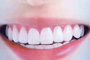 蘇州市立醫(yī)院整形科是否分布在不同的院區(qū)？蘇州市立醫(yī)院整形科在哪些院區(qū)開設(shè)？