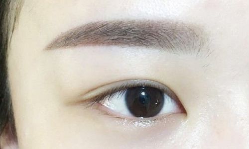 高水準醫(yī)生為您解密寧波楊加峰雙眼皮術(shù)的案例與技術(shù)！