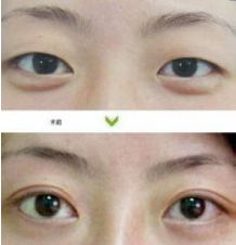 成都哪些醫(yī)生能力出眾進(jìn)行隆胸術(shù)？年度隆胸好醫(yī)生十大排名出爐