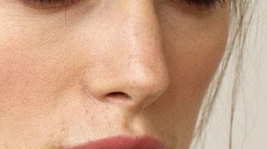 2023年杭州脂肪填充醫(yī)院選擇指南，靜港、時光等備受推崇