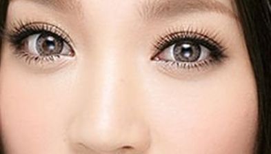 上海張余光醫(yī)生的鼻子整形，贏得大眾好評