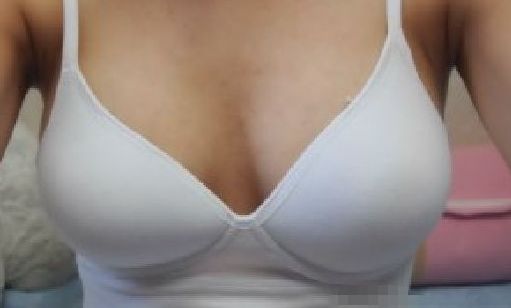 天后朱東磊鼻子整形效果如何？專家評(píng)估結(jié)果公開解析