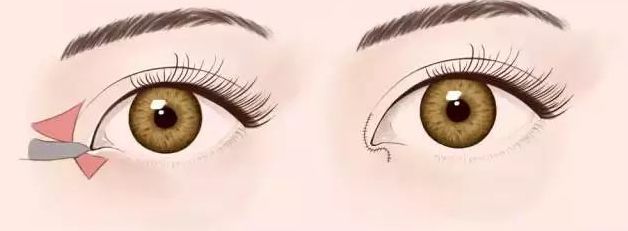 2023年福州整形醫(yī)院預(yù)計(jì)將迎來新的變革！