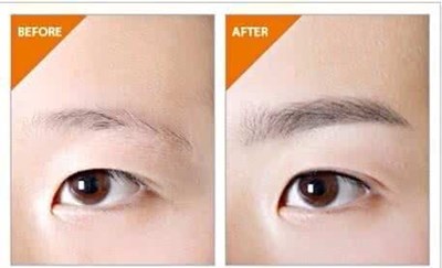 華西醫(yī)院整形外科靠譜嗎？手術(shù)費(fèi)用和專科精通的科室有哪些？