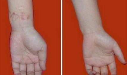 重慶暢美吸脂減肥醫(yī)院：革新技術(shù)引領(lǐng)行業(yè)，成就完美曲線