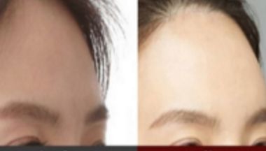 西安定點(diǎn)美容抽脂醫(yī)院大揭秘！挑選最適合你的減肥瘦身圣地