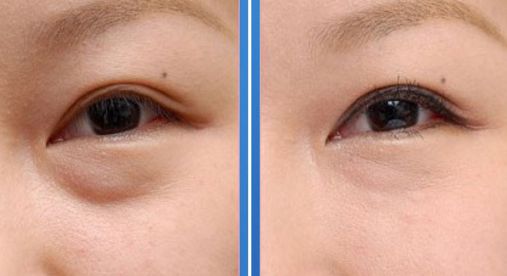 西安祛斑醫(yī)院綜合排行榜公開，全面解析正規(guī)專業(yè)醫(yī)院推薦