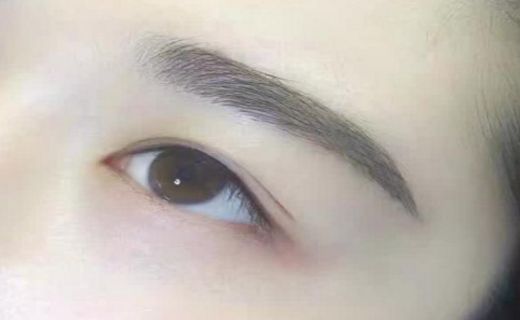 哈爾濱滕雙艷雙眼皮手術(shù)技術(shù)及成功案例全解析