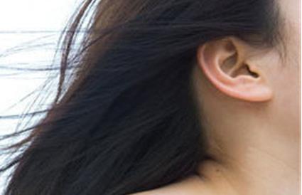 切眉后消腫需要多久才能恢復正常？需要注意哪些事項來促進消腫？