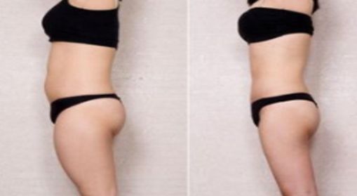 重慶五家優(yōu)秀整形醫(yī)院，值得推薦的附一院和聯(lián)合麗格！