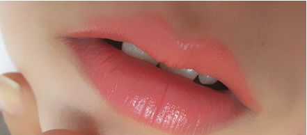 秦皇島頂級(jí)醫(yī)院一次雙眼皮手術(shù)價(jià)格揭秘，專家推薦+真實(shí)案例告訴你！