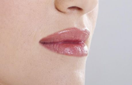 廣醫(yī)一院整形美容科：醫(yī)生實(shí)力強(qiáng)，雙眼皮案例為佐證