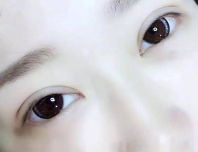 探秘秦皇島醫(yī)療機構(gòu)，深度了解雙眼皮手術(shù)的影響及推薦醫(yī)生星級！