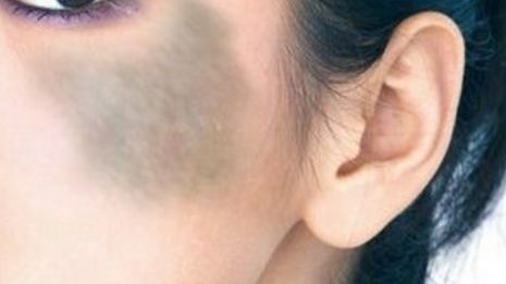 鎮(zhèn)江隆鼻醫(yī)院推薦：鎮(zhèn)江做隆鼻，這幾家醫(yī)院不可錯過！