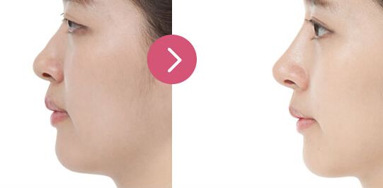 北京大學(xué)口腔醫(yī)院優(yōu)秀正畸科醫(yī)生推薦！