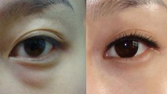 廣州哪家整形醫(yī)院最受好評？TOP3推薦！