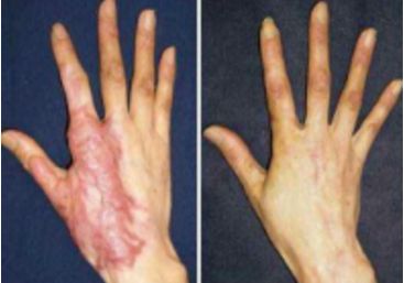 深圳市綜合整形醫(yī)院排行榜，口碑好的醫(yī)療機(jī)構(gòu)大揭秘！