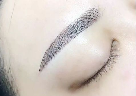 激光煥膚中心：祛眼袋效果有口皆碑，多位專家力薦