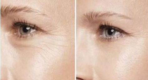 2023最佳杭州雙眼皮整形醫(yī)院排行榜揭曉！讓你雙眼瞬間變迷人的十大選擇！