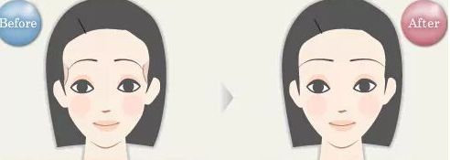 揭密石家莊哪位雙眼皮醫(yī)生備受關(guān)注，優(yōu)點(diǎn)揭秘，價(jià)格參考！