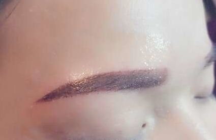 嘉興哪家雙眼皮整形醫(yī)院技術(shù)實(shí)力超群，備受矚目！