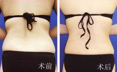 廣州非常受歡迎的整形專家解密！揭秘絕頂名醫(yī)，為你帶來全新穎解析！