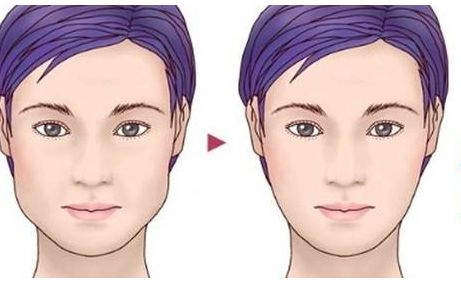 上海著名整形醫(yī)生李圣利的鼻子審美效果如何？網(wǎng)友親身經(jīng)歷分享實(shí)例。