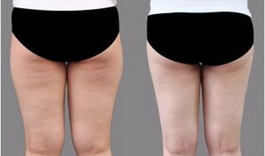 上海頂尖整容醫(yī)師團(tuán)隊(duì)曝光：專(zhuān)為改善臉型而生！