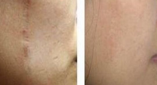 廣州華美整形美容醫(yī)院的醫(yī)生推薦和整形項(xiàng)目收費(fèi)情況詳解