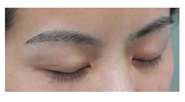 浙江整形醫(yī)院大放異彩！杭州、溫州、寧波都爭(zhēng)相嶄露頭角！