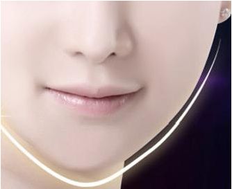 大連趙穆欣雙眼皮整形：專家實(shí)力與成功案例匯總！