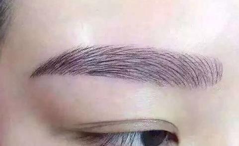 寧波海曙清媛醫(yī)療美容診所擅長哪些項目？為你推薦哪些值得一試的項目？