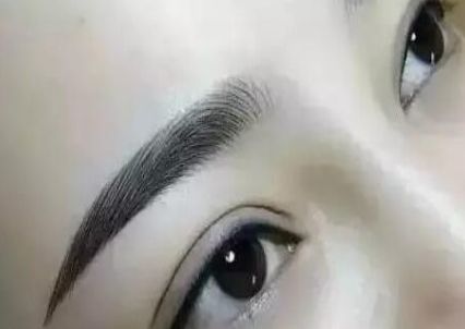 選擇最適合您的雙眼皮手術(shù)醫(yī)院-專業(yè)的推薦