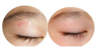 山東省最受推崇的雙眼皮手術(shù)醫(yī)院排名公布！專家推薦，精選高評分！