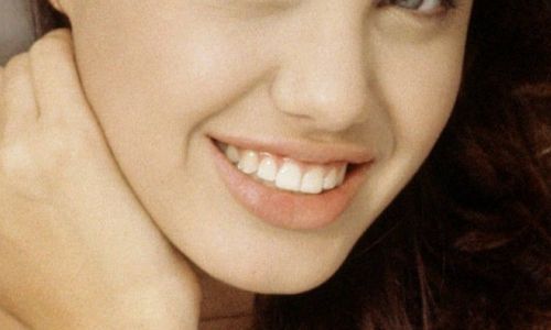 北京八大處整形外科院內資深專家團隊帶您探尋雙眼皮案例精彩賞析