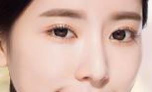 上海薇琳全身吸脂效果好嗎？