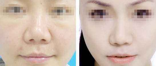 西安整形醫(yī)療機構(gòu)搶先座次，多家私立醫(yī)美機構(gòu)震撼效果排在最前！