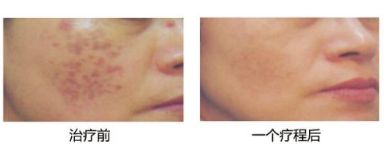 曾昂醫(yī)生的預(yù)約掛號方式及隆胸日記分享