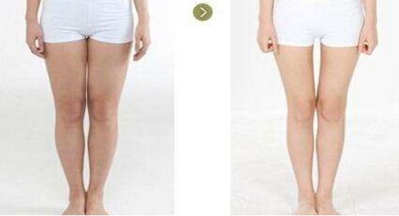 2023年上海副乳吸脂手術(shù)七大名醫(yī)推薦，醫(yī)生排行榜震撼來襲