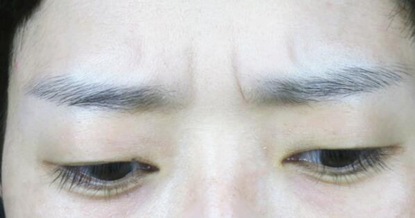 河北醫(yī)科大學(xué)第二醫(yī)院項目有哪些？醫(yī)生技術(shù)如何提供？