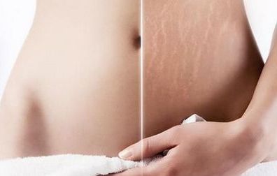 合肥最受推薦的去眼袋整形醫(yī)院，排行榜TOP6呈現(xiàn)您！