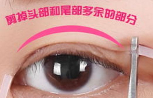 樂山市人民醫(yī)院眼袋手術(shù)口碑如何？醫(yī)生推薦+真實(shí)案例分析