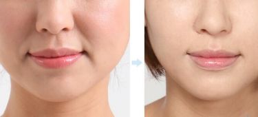 上海最佳隆鼻醫(yī)生推薦！5位實(shí)力醫(yī)生值得參考