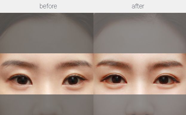 【特約】重慶鼻整形手術(shù)修復(fù)醫(yī)生五強名單揭曉，專家推薦！