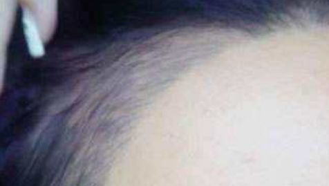 杭州隆胸醫(yī)院，解鎖完美身材，助你歡度自信人生！